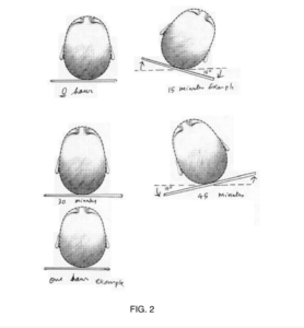 FIG. 2